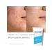 NEUTRIHERBS Cleaning gel facing faces with salicylic acid - Buy Online on GoSupps.com