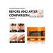 Eelhoe bronzing gel to restore tanning 2 pcs - Buy Online on GoSupps.com