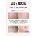Stretch mark cream for pregnant women - Buy Online on GoSupps.com