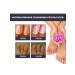 Ouhoe Restore damaged nails the essence to remove fungi - Buy Online on GoSupps.com