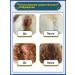 Spray from cutting lichen for cats and dogs 100 ml - Buy Online on GoSupps.com