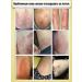 Ointment from psoriasis from eczema from dermatystabystro and effectively - Buy Online on GoSupps.com
