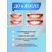 Family Cosmetics Tarty paste Triple protection with a dispenser of 17pcs - Buy Online on GoSupps.com