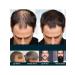 eastmoon Hair growth Essence male alopecia decrease in falling out - Buy Online on GoSupps.com