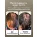 carefully organic Hair growth whey against falling out - Buy Online on GoSupps.com