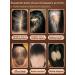 Professional Hair growth Dodoyuri - Buy Online on GoSupps.com