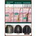 Professional Hair growth Dodoyuri - Buy Online on GoSupps.com