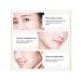 12pcs bag of threads for facial lifting resolved collagen - Buy Online on GoSupps.com