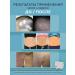 Ointment from psoriasis - Buy Online on GoSupps.com