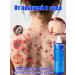 IUALLURE Shower gel from acne 300 ml removes ticks