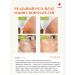 TOKISHI SB Acne cream serum - Buy Online on GoSupps.com