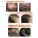 LYDIMOON Women's hair shampoo nourishes the scalp - Buy Online on GoSupps.com
