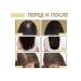 eelhoe decrease in the loss of essential oil improves hair fragility - Buy Online on GoSupps.com