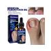 West & Month Grown Noga on the toe Oil for caring for ... - Buy Online on GoSupps.com