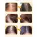 DRSKINVITA 250 ml of shampoo against hair loss - Buy Online on GoSupps.com