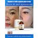 Serum with niacinamide for bleaching pigment spots - Buy Online on GoSupps.com