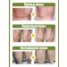 Cream from varicose veins 20g relieves pain and swelling - Buy Online on GoSupps.com