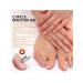 Eelhoe treatment of nail fungus gel for care for the horn layer - Buy Online on GoSupps.com