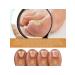 Eelhoe treatment of nail fungus gel for care for the horn layer - Buy Online on GoSupps.com