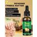 JaySuing Ginger care of nails with a solution of fungal infections