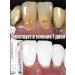 Toothpaste whitening without fluorine