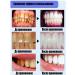 Toothpaste whitening without fluorine - Buy Online on GoSupps.com
