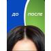 Head & Shoulders Hair Shampoo Mentol-5 pcs - Buy Online on GoSupps.com