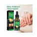 Jaysuing treatment of nail fungus tool for nail care - Buy Online on GoSupps.com