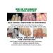 Jaysuing treatment of nail fungus tool for nail care - Buy Online on GoSupps.com