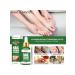 WEST & MONTH Antifungal nail tool 3 pcs - Buy Online on GoSupps.com
