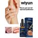Wiyun nail oil antifungal-10ML