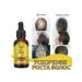 eelhoe Prevent hair loss Essence nourishes the scalp - Buy Online on GoSupps.com