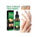 30ml ginger sulfur for nails against the fungus moisturizing