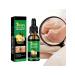 30ml ginger sulfur for nails against the fungus moisturizing - Buy Online on GoSupps.com