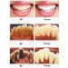 LYDIMOON Toothpaste to remove tooth stone and bleaching teeth - Buy Online on GoSupps.com