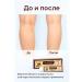 NozaYa Cream from varicose veins to remove edema - Buy Online on GoSupps.com