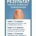 PatiMari Cream antifungal for nails - Buy Online on GoSupps.com