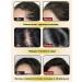 Shampoo for hair growth and loss with ginger and ginseng - Buy Online on GoSupps.com