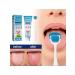 Eelhoe cleansing the tongue from plaque elimination of an unpleasant odor ...