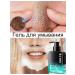 Gel for washing the face from acne and black dots