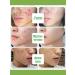 DRSKINVITA Acne cream for women 30g - Buy Online on GoSupps.com