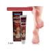 MaxWish 09 Chinese miracle cream for cracked heels 1 pcs