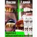 LYDIMOON Toothpaste prevention of gum disease for 100 g