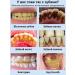 Lydimoon toothpaste from pollution against caries - Buy Online on GoSupps.com