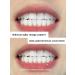 Whitening toothpaste eliminates pigmentation on the teeth - Buy Online on GoSupps.com