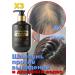 Shampoo against falling out and for the growth of the wave （3 bottles）