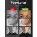 HoneyCare Facial teips transparent from wrinkles - Buy Online on GoSupps.com