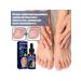 Lacques for an ingrown nail from the fungus for treatment 4 pcs - Buy Online on GoSupps.com