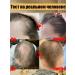Ginger shampoo against hair loss and hair growth - Buy Online on GoSupps.com