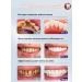 BEAUTITEM Bleaching toothpaste bleach for teeth 120 ml - Buy Online on GoSupps.com